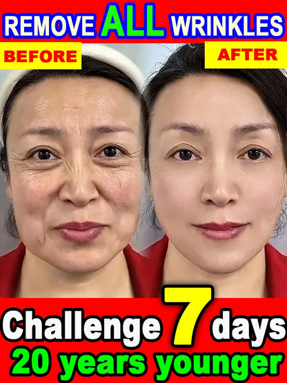 POZOAMIS | Glyceryl Glucoside Hyaluronic Acid | Anti Aging Serum