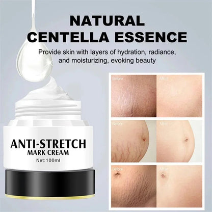 Removes Stretch Mark Cream Postpartum Repair Fade Stretch Marks Prevent Obesity Lifting Firming Moisturizing Brighten Skin Care