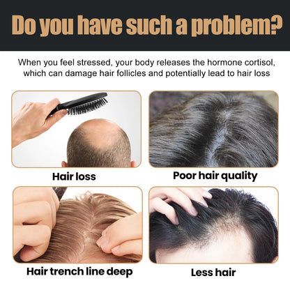 Shampoo Gently Clean Hair Remove Dandruff Control Oil Reduce Hair Loss Stabilize Hair Roots Nourish Smooth Hair Fluffy Shampoo