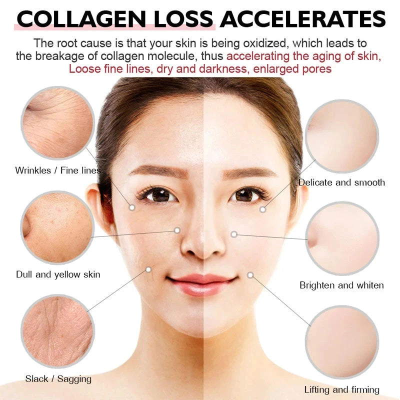 Pslalae | Collagen Gummies with Superfruit Blend | Hair, Skin, Joints, Digestion & Immune Support | 60 Gummies