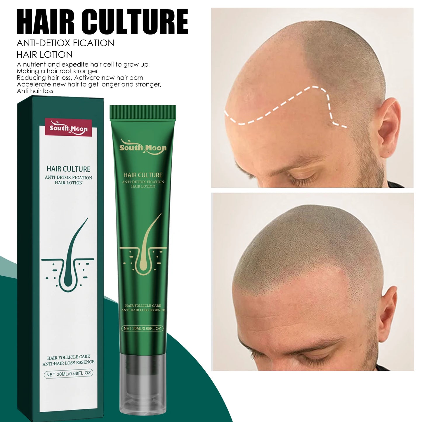 Anti-Hair Loss Serum Thinning Balding Treatment Oil Strengthen Hair Roots For Scalp Health Care Essence 20/30ml