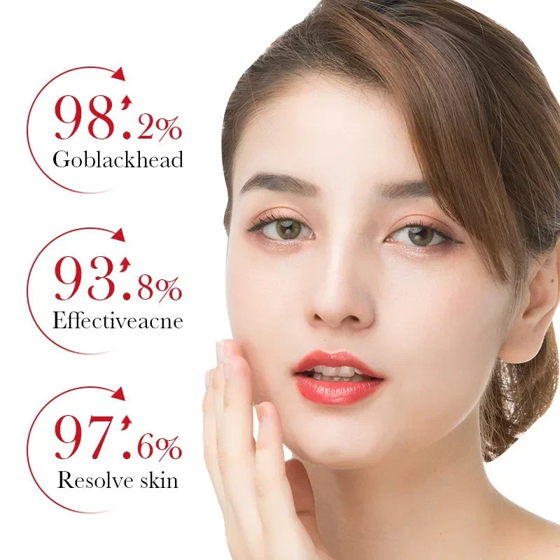 BIOAQUA | Salicylic Acid | Acne Treatment, Mark Repair, Blackhead Removal, Firming & Moisturizing Facial Cream | Skincare