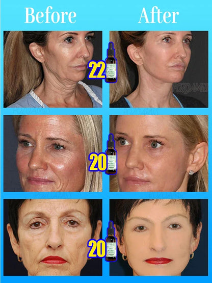 POZOAMIS | Glyceryl Glucoside Hyaluronic Acid | Anti Aging Serum