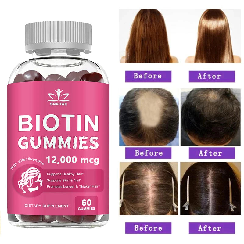 SNGHWE | Collagen & Biotin Gummies| Hair Growth, Skin & Nail Support | 60 Gummies