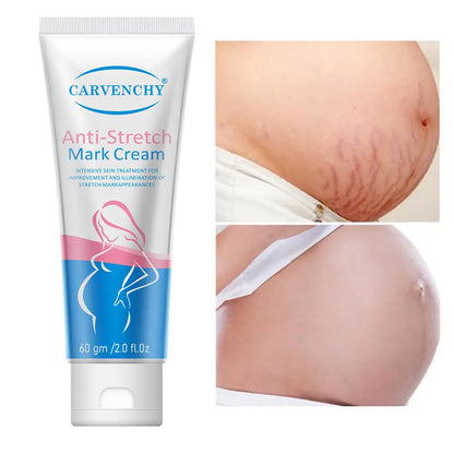 Anti Stretch Mark Cream Repair And Fade Fine Lines, Postpartum Fat Line Repair Cream