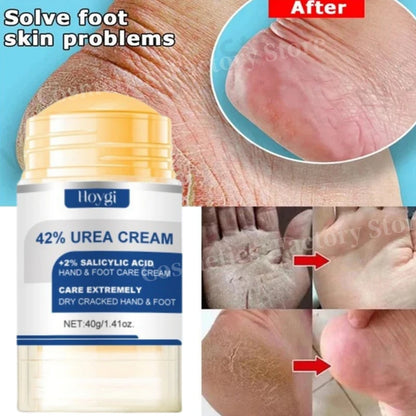 60% Urea Foot Cream Aloe Vera Ultra-hydrating Softening Dry Cracked Feet Cream Gentle Exfoliation Daily Foot Care Solution 40g