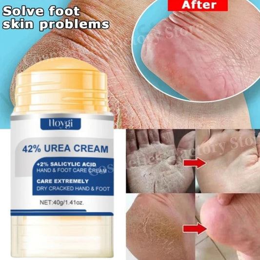 60% Urea Foot Cream Aloe Vera Ultra-hydrating Softening Dry Cracked Feet Cream Gentle Exfoliation Daily Foot Care Solution 40g