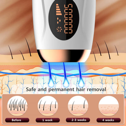 Portable IPL Laser Epilator | 999,999 Flashes | Painless Permanent Hair Removal for Women’s Body & Bikini Line