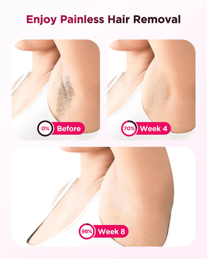 IPL Hair Removal Device | Ice-Cooling 3-in-1 | Painless Permanent Body Treatment