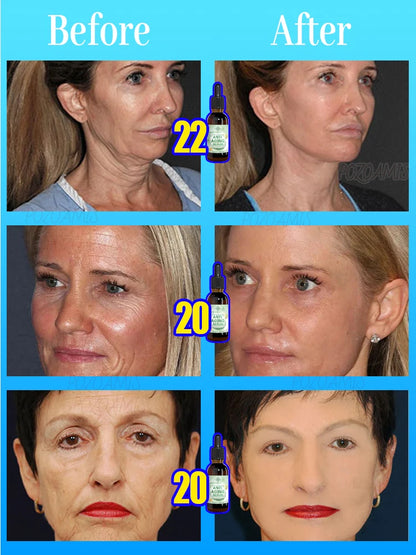 POZOAMIS | Glyceryl Glucoside Hyaluronic Acid | Anti Aging Serum