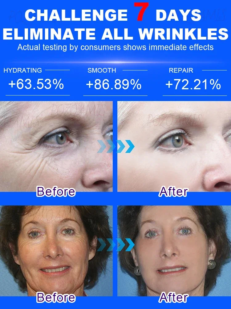 POZOAMIS | Glyceryl Glucoside Hyaluronic Acid | Anti Aging Serum