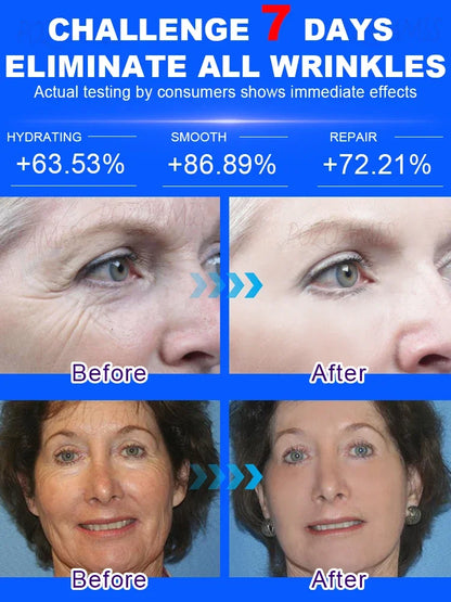 POZOAMIS | Glyceryl Glucoside Hyaluronic Acid | Anti Aging Serum