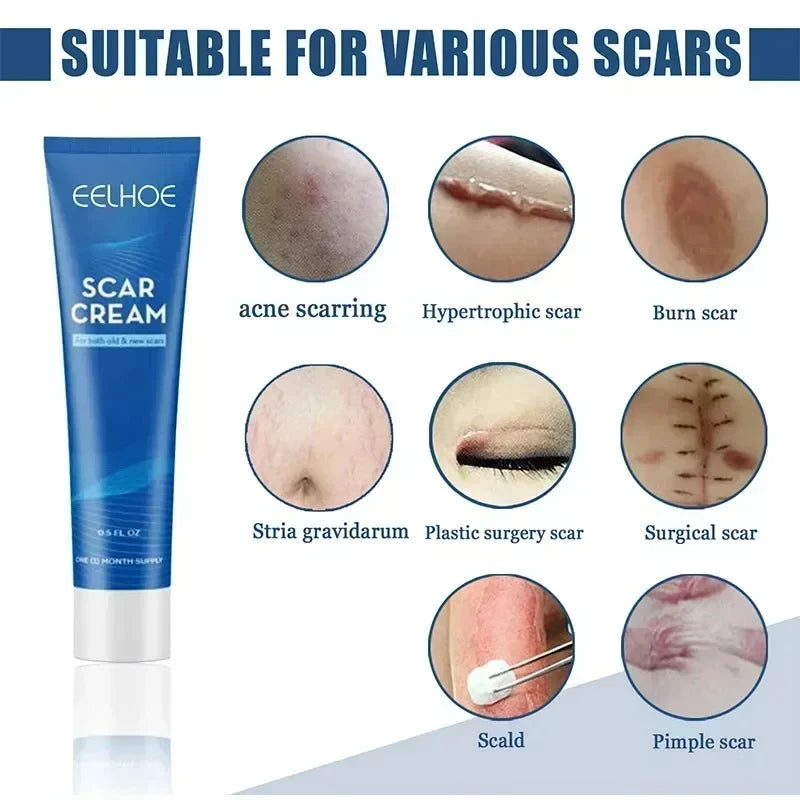15g Scar Removing Cream Stretch Mark Removal Gel Face Body Acne Marks Injury Cesarean Burn Abrasions Scars Skin Repair Cream