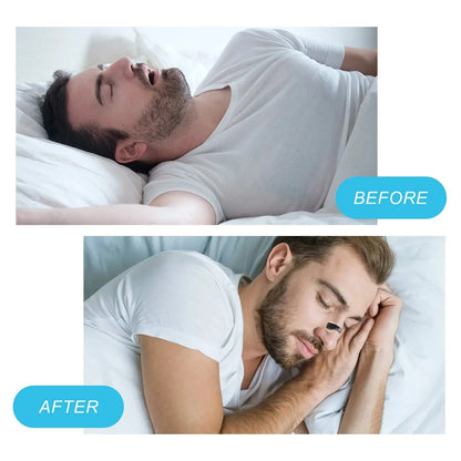 Premier Nasal Dilator|Magnetic Nose Clip|Anti-Snoring, Breathing Support & Sleep Support