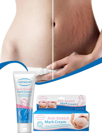 Anti Stretch Mark Cream Repair And Fade Fine Lines, Postpartum Fat Line Repair Cream