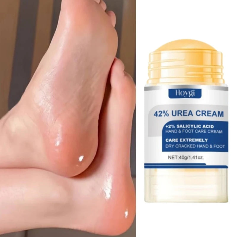 60% Urea Foot Cream Aloe Vera Ultra-hydrating Softening Dry Cracked Feet Cream Gentle Exfoliation Daily Foot Care Solution 40g