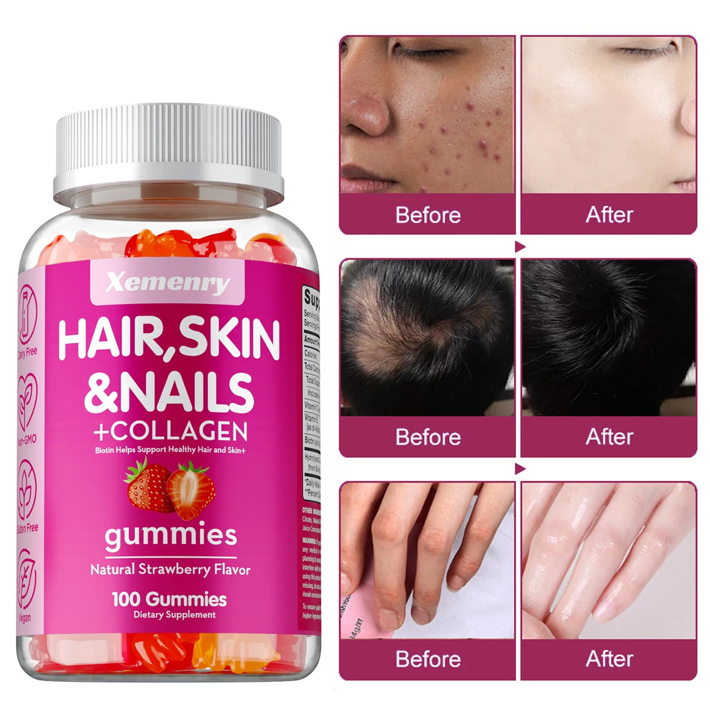 Xemenry | High Potency Biotin Gummies with Collagen | Healthy Hair, Skin & Nails Support | 60 Gummies