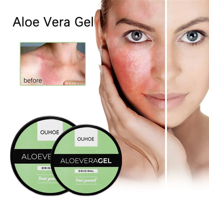 OUHOE Aloe Vera Gel | Original Formula for Sunburn Relief & Skin Soothing | Summer Hydration & Repair | 200g