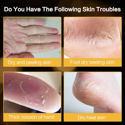 Intensive Cracked Skin Hydrating Balm – Ultra-Moisturizing Foot & Hand Cream for Dry, Rough Heels | Anti-Fissure & Nourishing