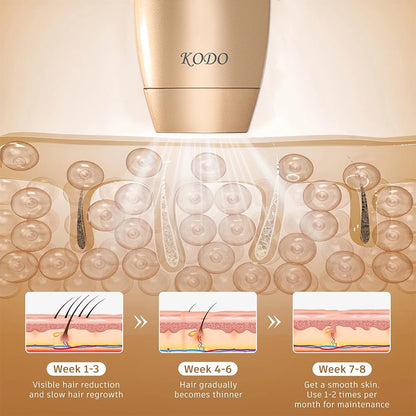 KODO 2025 High-End Ice Laser Hair Removal | 4-in-1 Permanent IPL Photoepilator for Face & Body