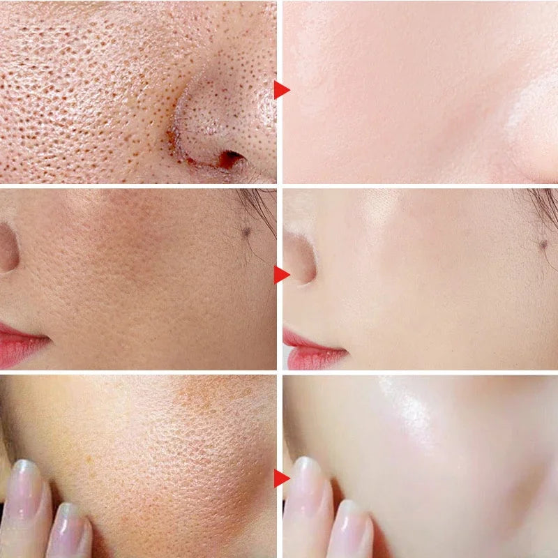 Dimollaure Face Whitening Cream Removal Freckle Melasma Pigment Melanin Sunburn Pregnancy Spots Acne Dark Spots Skin Care