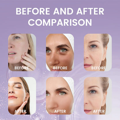 SAUVASINE Bakuchiol Face Serum | Natural Retinol Alternative | Anti-Aging, Wrinkle-Fading & Firm-Hydrating Care | 30ml