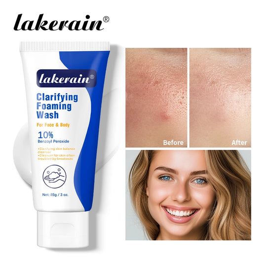 Lakerain | Benzoyl Peroxide 10% | Acne Treatment & Deep Cleansing