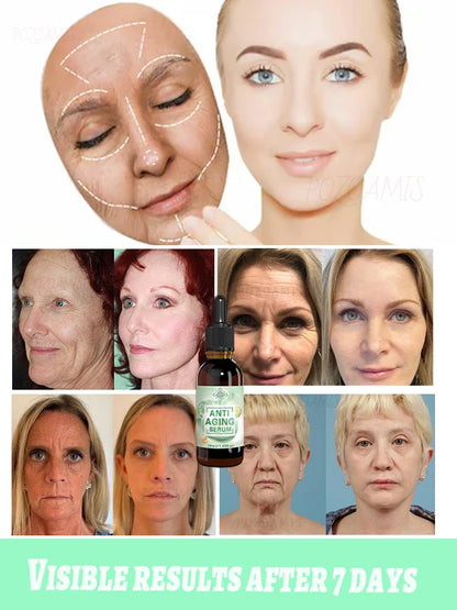 POZOAMIS | Glyceryl Glucoside Hyaluronic Acid | Anti Aging Serum