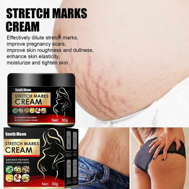 Effective Remove Pregnancy Scars Acne Cream Stretch Mark Treatment Maternity Repair Anti-Aging Anti-Winkle Firming Body Cream