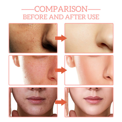 JAY SUING 5-in-1 Professional Facial Serum | Hyaluronic Acid, Vitamin C, Niacinamide, Collagen & Vitamin E | Anti-Wrinkle, Spot-Fading & Pore-Minimizing | 30ml
