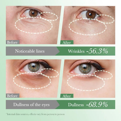 FAYANKOU | Centella Asiatica | Anti-Dark Circles, Anti-Wrinkle, Eye Bag Reduction, Moisturizing
