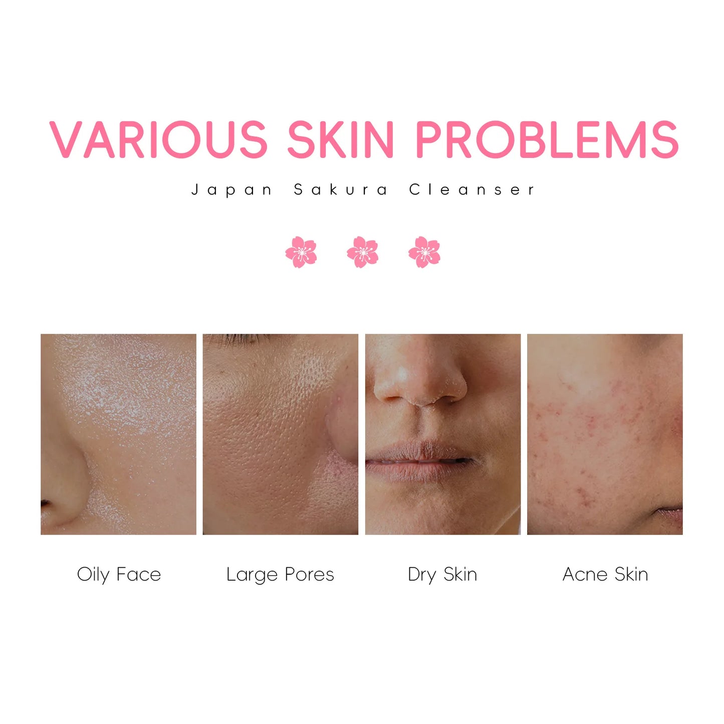 LAIKOU | Sakura Extract | Blackhead Removal & Pore Minimizing