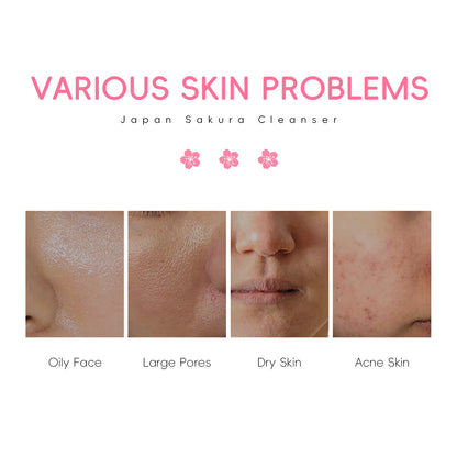 LAIKOU | Sakura Extract | Blackhead Removal & Pore Minimizing