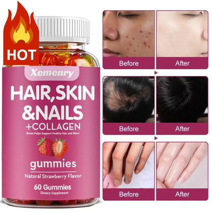 Xemenry | Biotin & Vitamin Gummies with Collagen | Hair, Skin & Nails Support | 60 Gummies