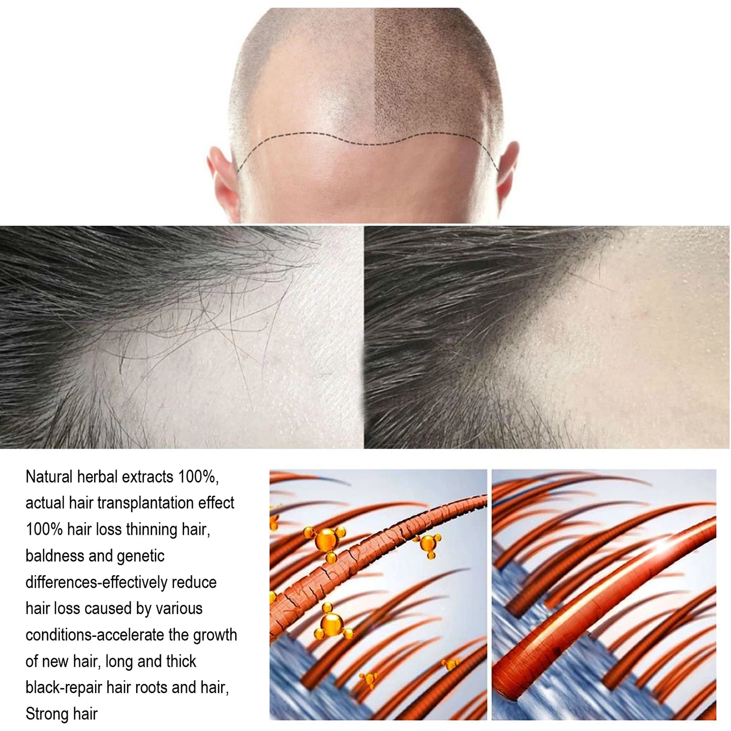 Anti-Hair Loss Serum Thinning Balding Treatment Oil Strengthen Hair Roots For Scalp Health Care Essence 20/30ml