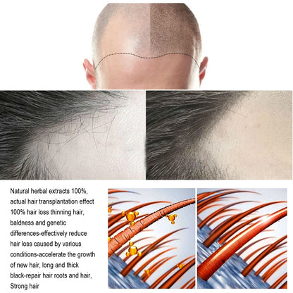 Anti-Hair Loss Serum Thinning Balding Treatment Oil Strengthen Hair Roots For Scalp Health Care Essence 20/30ml