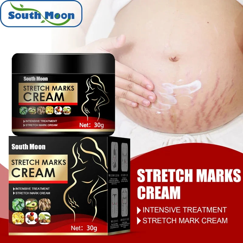 Effective Remove Pregnancy Scars Acne Cream Stretch Mark Treatment Maternity Repair Anti-Aging Anti-Winkle Firming Body Cream