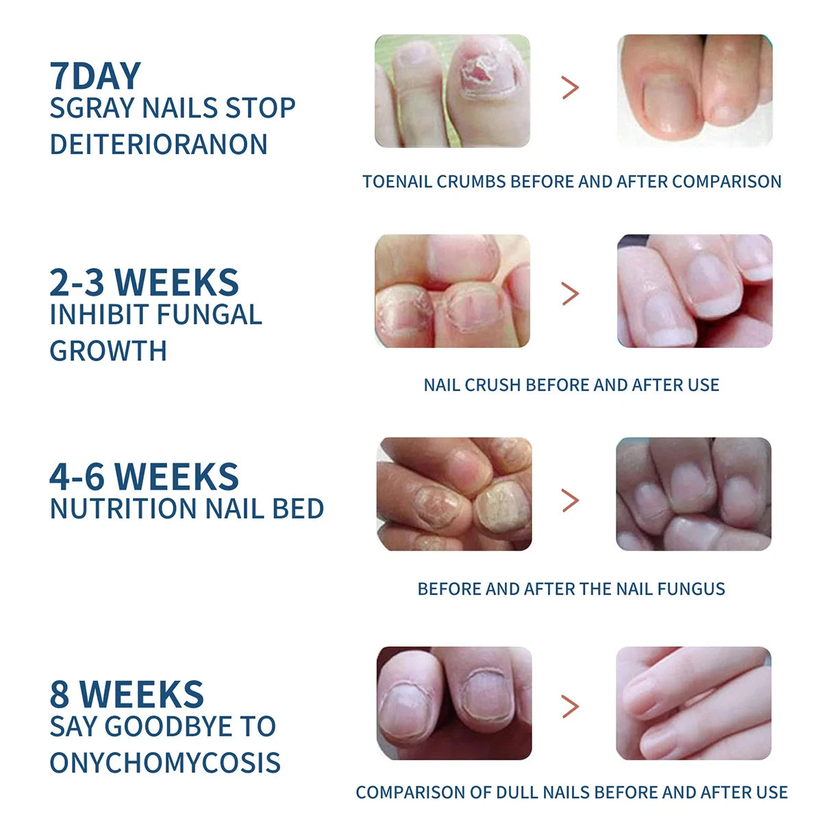 Nail Care Essence With Natural Ingredients To Improve The Appearance Of Nails And Keep Them In Good Condition