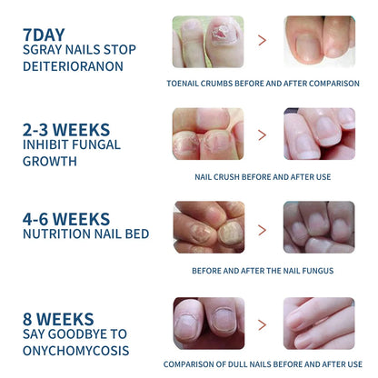 Nail Care Essence With Natural Ingredients To Improve The Appearance Of Nails And Keep Them In Good Condition