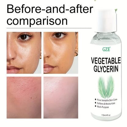 GZE Vegetable Glycerin | 100% Pure & Natural | Softening, Moisturizing & Multi-Purpose Skin Care
