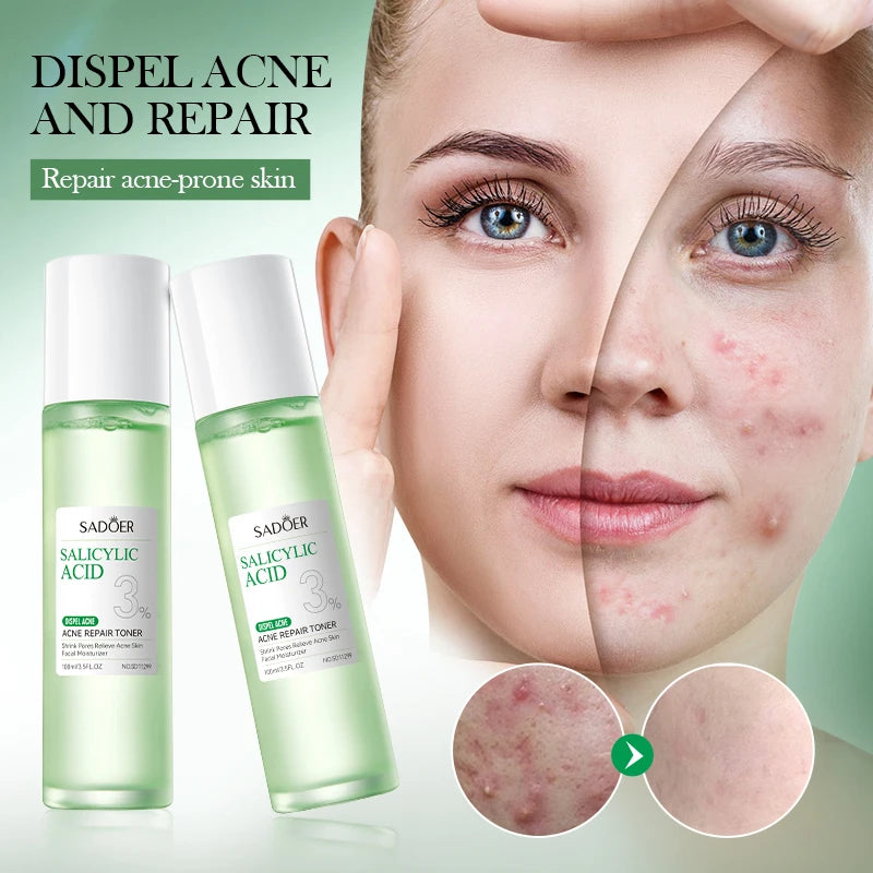 SADOER | 3% Salicylic Acid Acne Repair Toner | Acne Control, Pore Minimizing & Skin Soothing