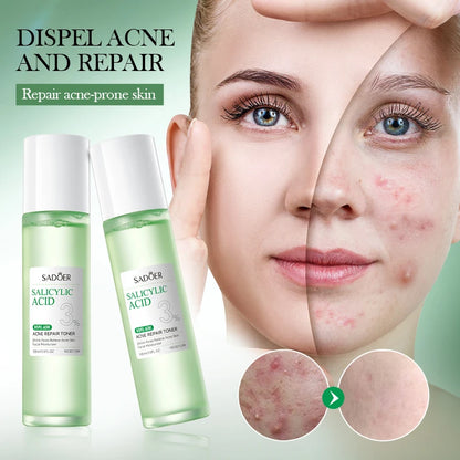 SADOER | 3% Salicylic Acid Acne Repair Toner | Acne Control, Pore Minimizing & Skin Soothing