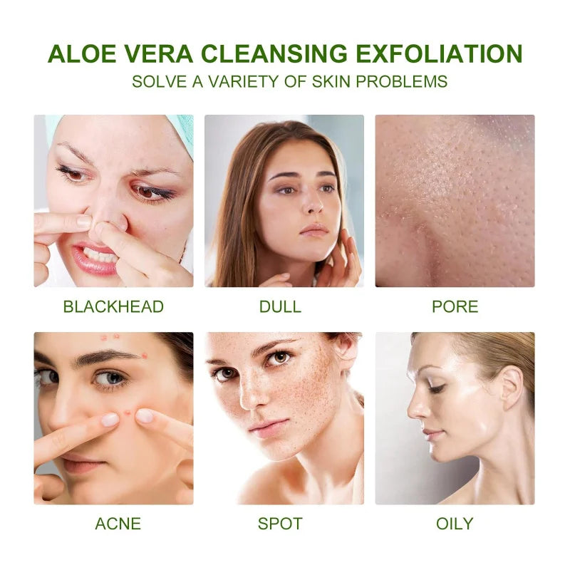 Aloe Vera Body Scrub - Deep Clean Skin, Exfoliate, Moisturize Pores, Reduce Acne Marks, Soften Skin, Brighten Complexion, 100g