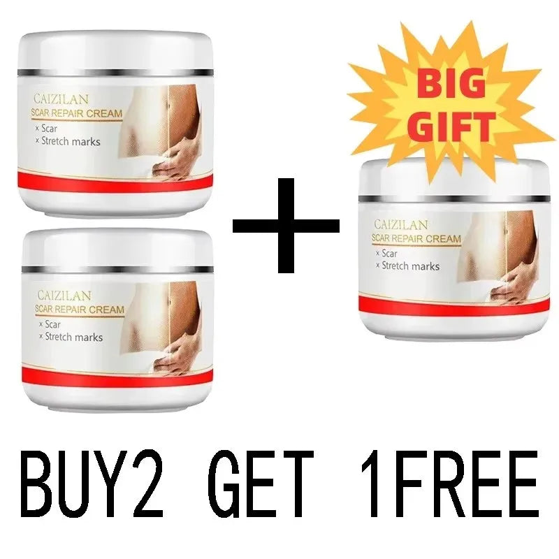 Stretch Marks Permanent Removal Cream Eliminate Body Belly Stretch Marks Swelling Marks Remove Skin Cracks Repair Firming Care