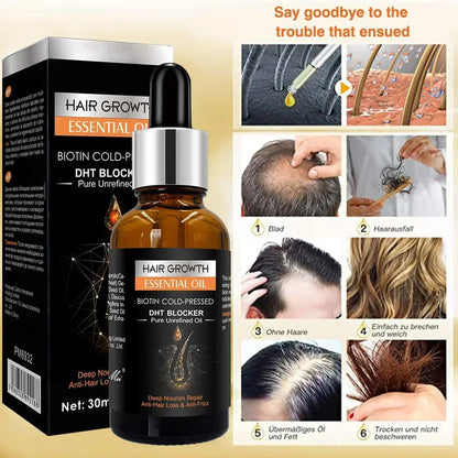 High Repurchase,Hair Growth Oil,Biotin DHT Blocker,Anti-Loss Shampoo,Boost Regrowth,Increase Production of Shampoo,hair Growth