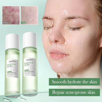 SADOER | 3% Salicylic Acid Acne Repair Toner | Acne Control, Pore Minimizing & Skin Soothing