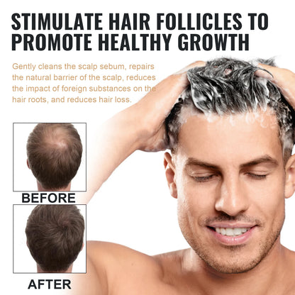 Shampoo Gently Clean Hair Remove Dandruff Control Oil Reduce Hair Loss Stabilize Hair Roots Nourish Smooth Hair Fluffy Shampoo