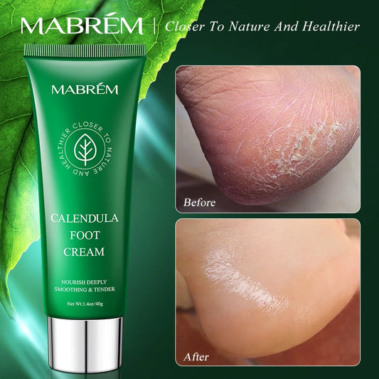 MABREM Foot Treatment Cream Whitening Anti-cracking Moisturizing  Protection Cream Relive Pain Foot Cream Exfoliating Scrub 40g