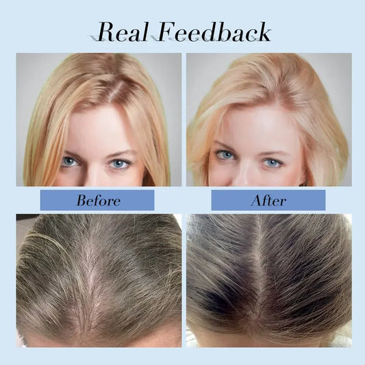 1 Pcs Hair Growth Shampoo Anti Hair Loss Care Products Regrowth Treatment Conditioner Thickener Men Women Beauty Health 400ml