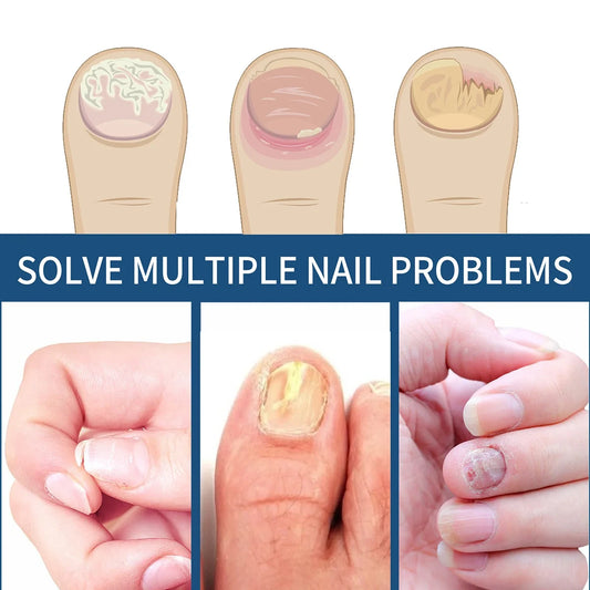 Nail Care Essence With Natural Ingredients To Improve The Appearance Of Nails And Keep Them In Good Condition